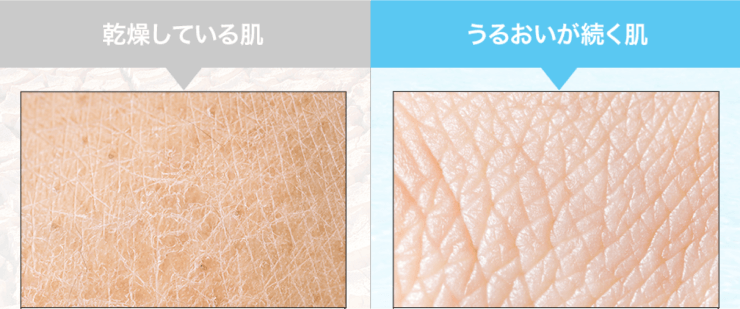 乾燥している肌と潤っている肌の写真